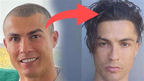 cristiano ronaldo hair loss